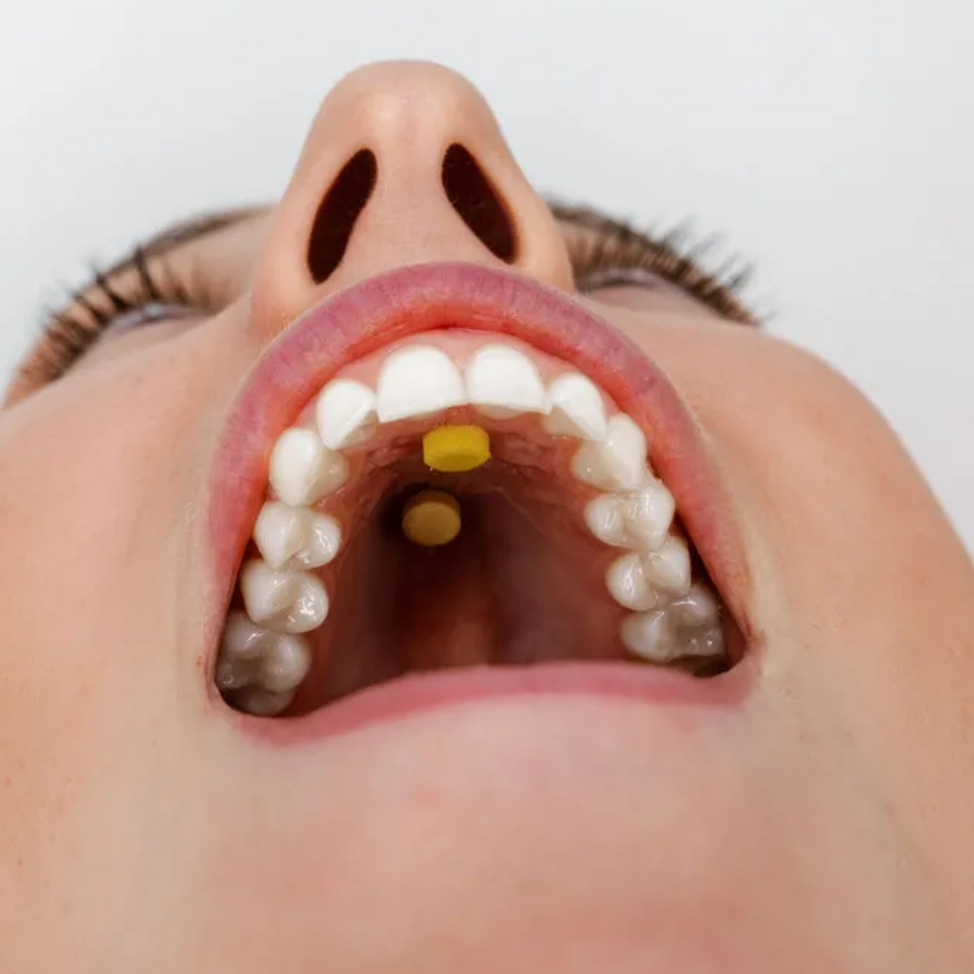 MYOSPOTS - hjælper din tunge op i ganen